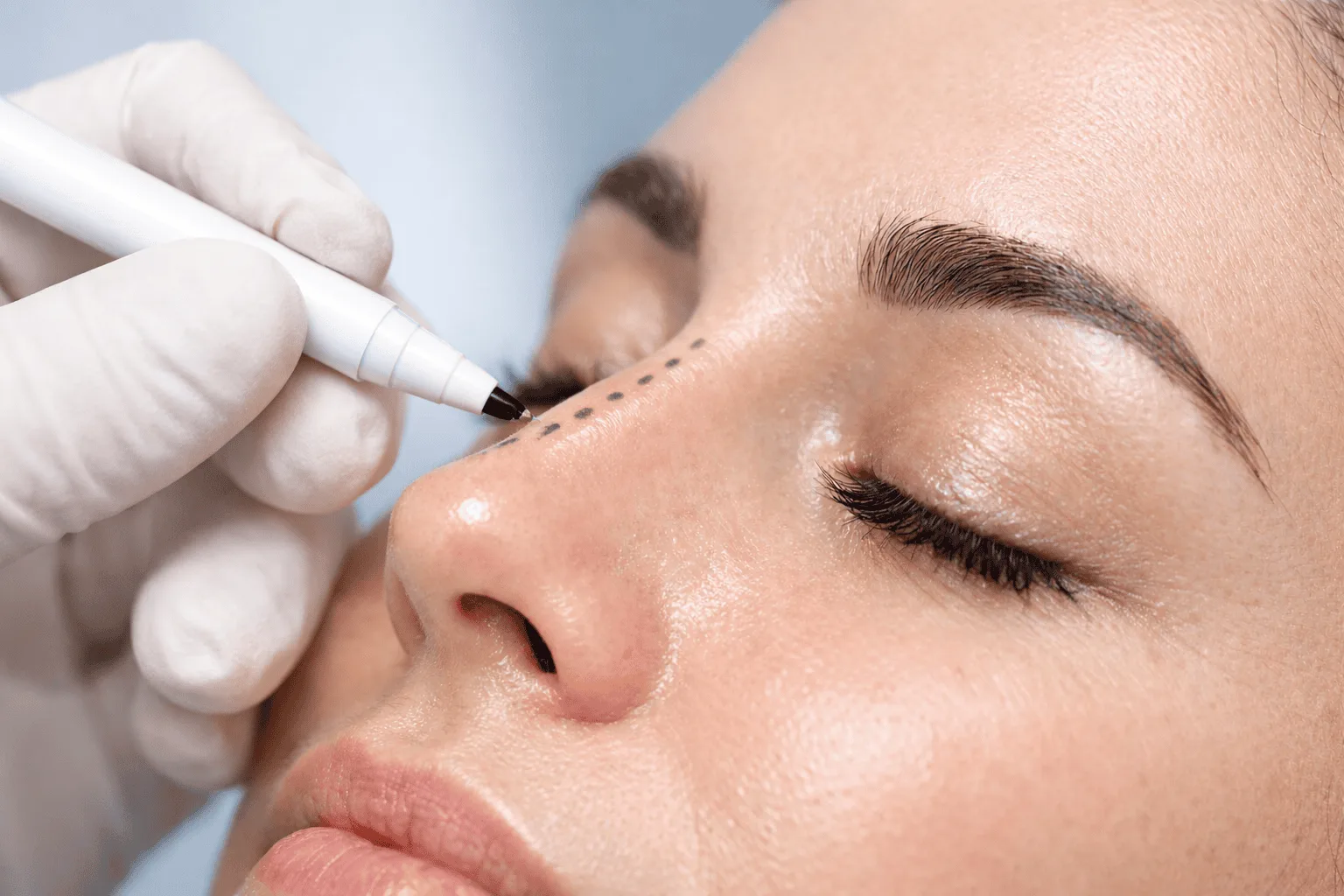 Non-Surgical Rhinoplasty