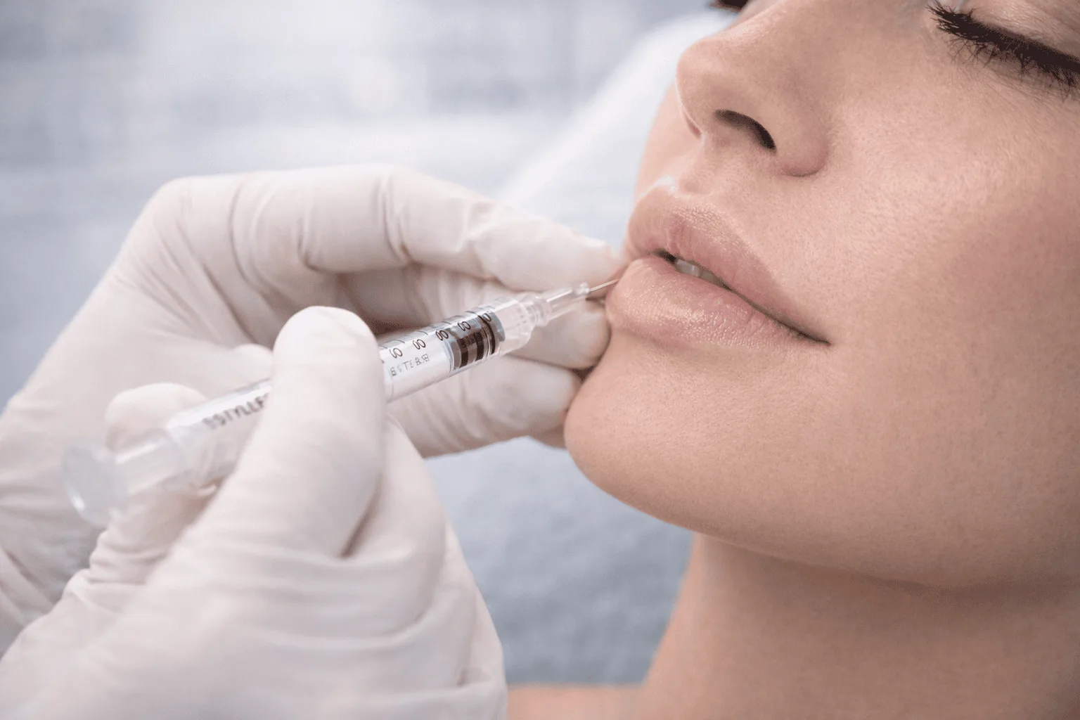 Lip Filler