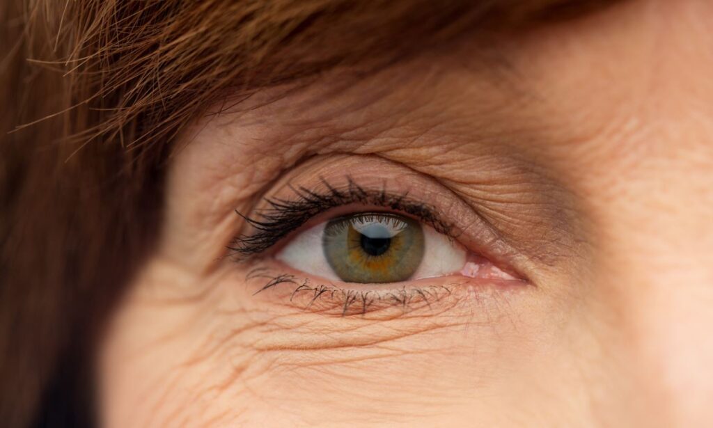 Nucleofill eyes uygulaması nedir? Faydası nedir, zararları var mı? Ücreti - fiyatları